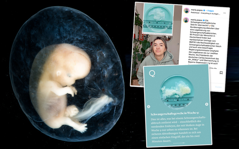 Embryo (l.) oder nur Schwangerschaftsgewebe?