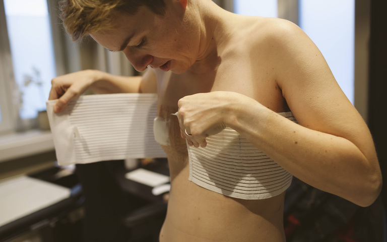 Junge Frau nach einer Masektomie